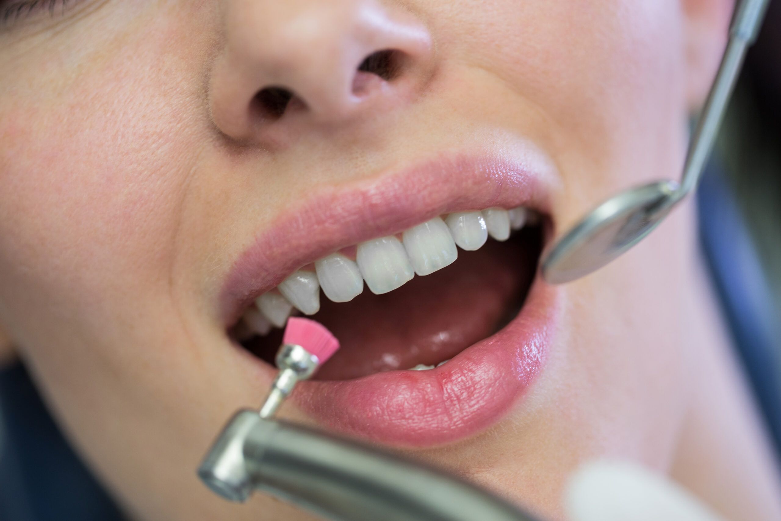 Estética dental